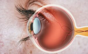 Cornea