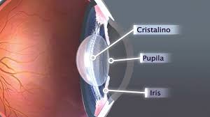Cristalino